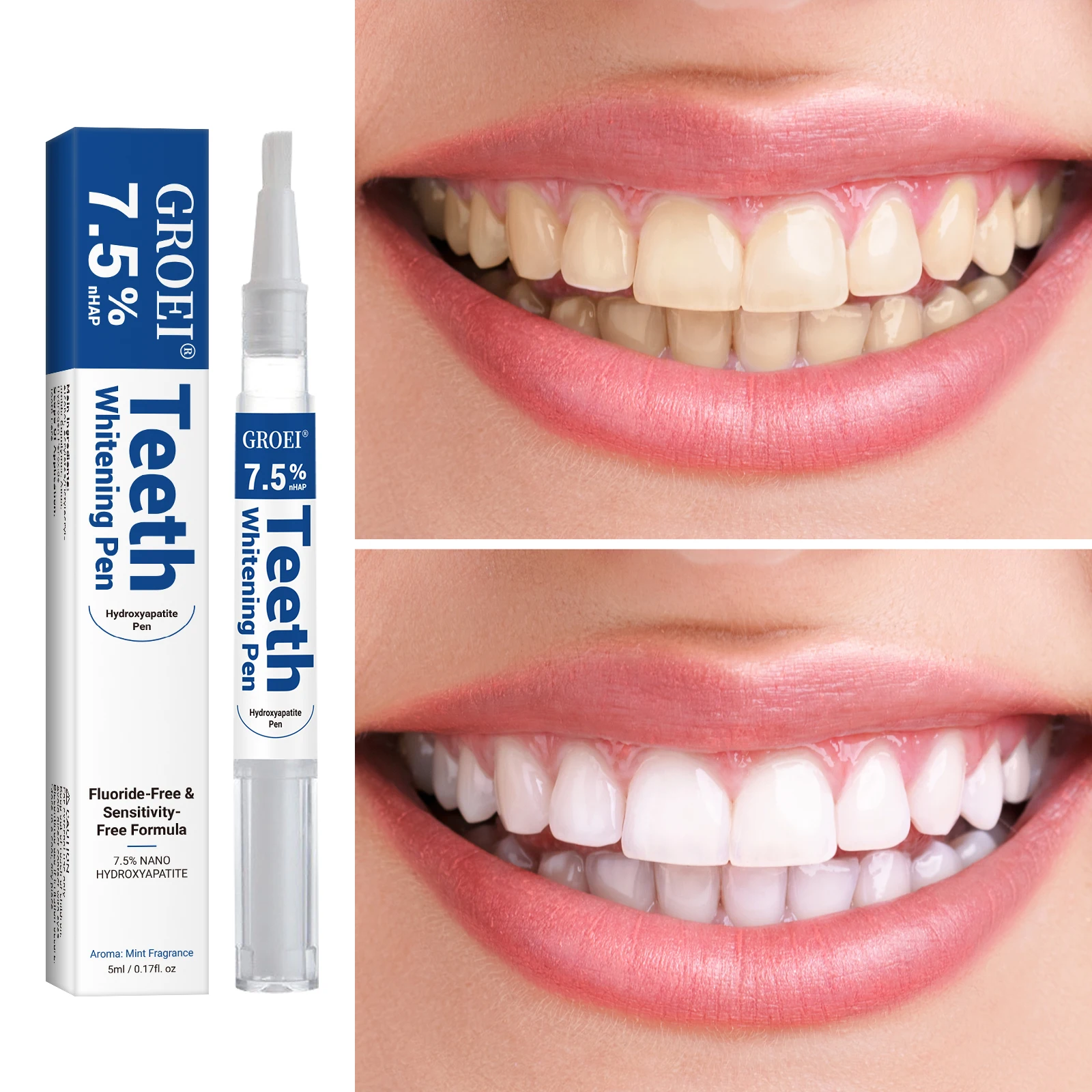 Hidroksiapatit Diş Beyazlatma  - Teeth Whitening Clinic incelemesi ve fiyatı
