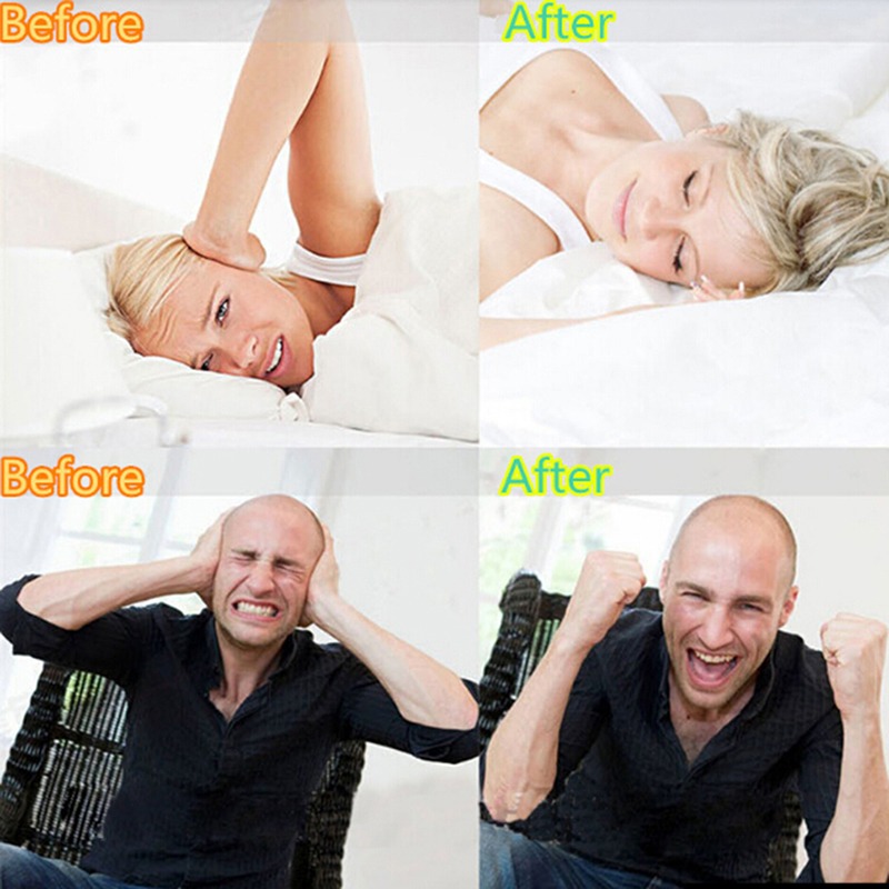 Silikon Diş Sıkma Önleyici Ağı - Dental Guard Night incelemesi ve fiyatı