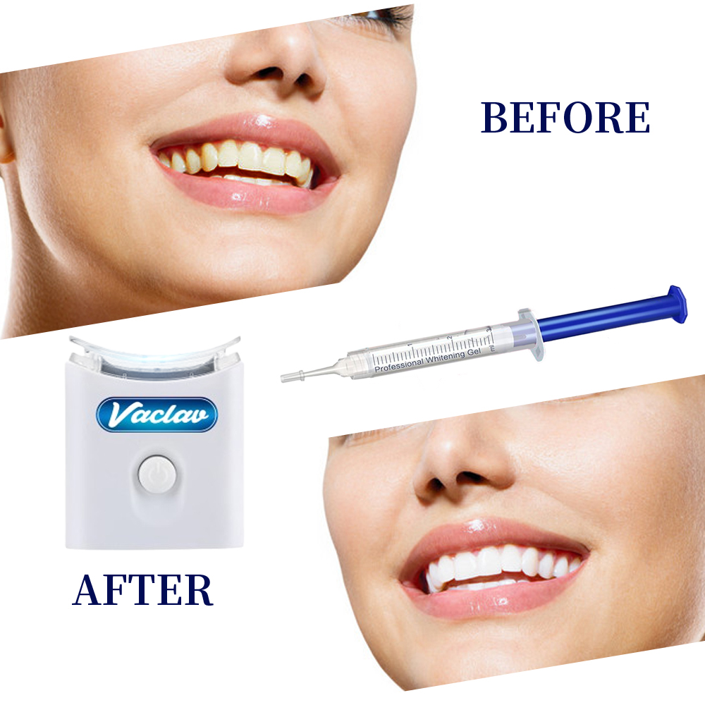 Nane Diş Beyazlatma Jeli Şırın - Teeth Whitening Gel Syringes incelemesi ve fiyatı