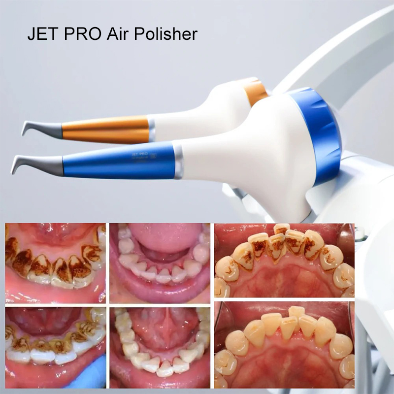 VV Dental Hava Parlatma Prophy - Teeth Whitening Usa incelemesi ve fiyatı