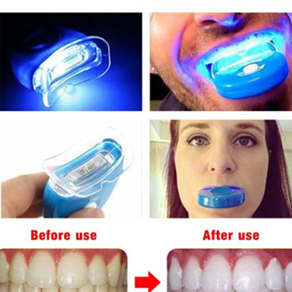 Yeni mavi Led diş beyazlatma h - Teeth Whitening Uv Kit incelemesi ve fiyatı